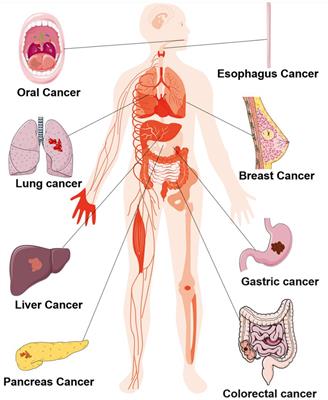 The role of oral microbiota in cancer